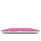 Stripe Pink - MacBook Case