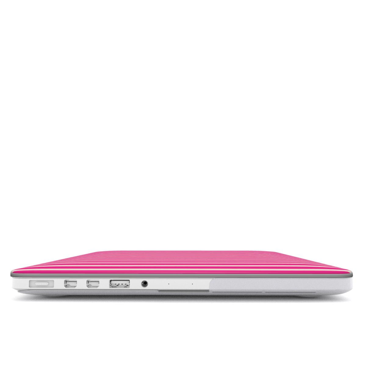 Stripe Pink - MacBook Case