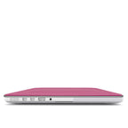 Stripe Berry - MacBook Case