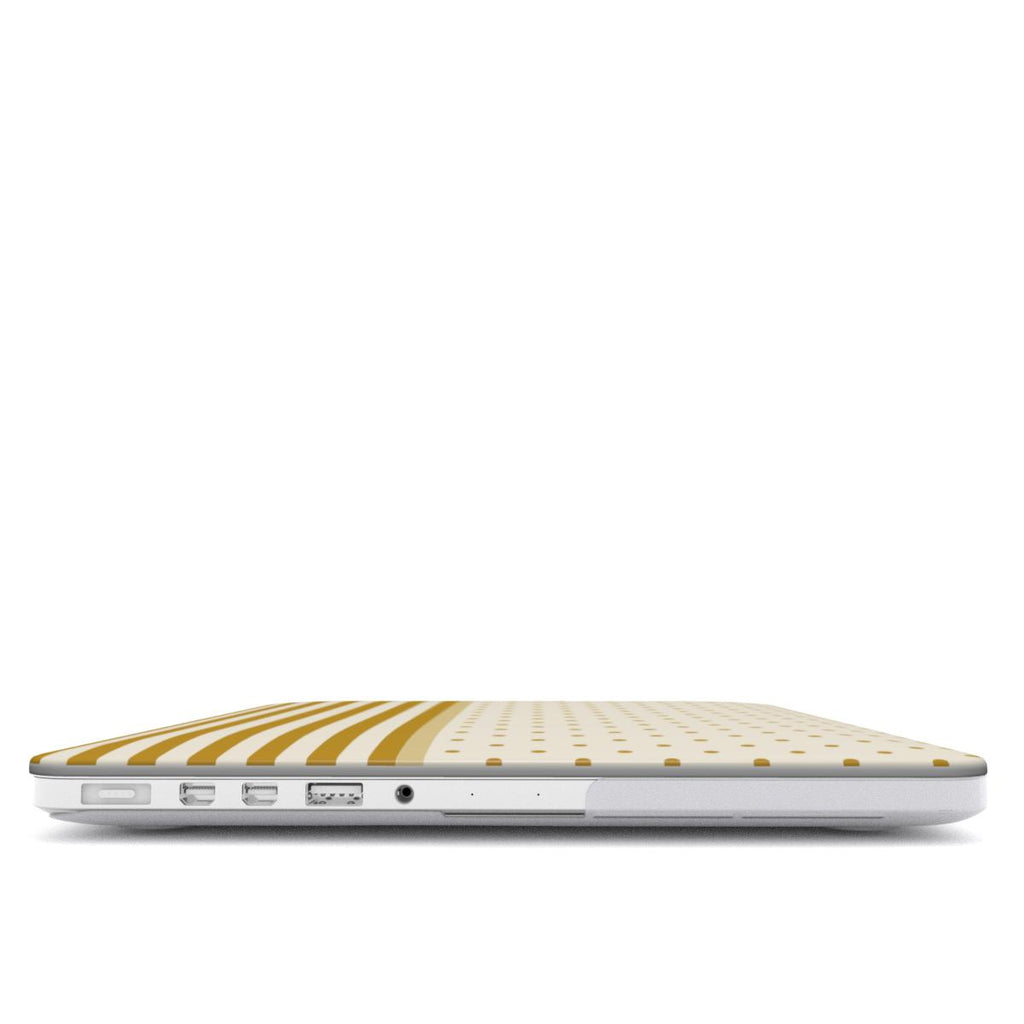 Butter Yellow - MacBook Case