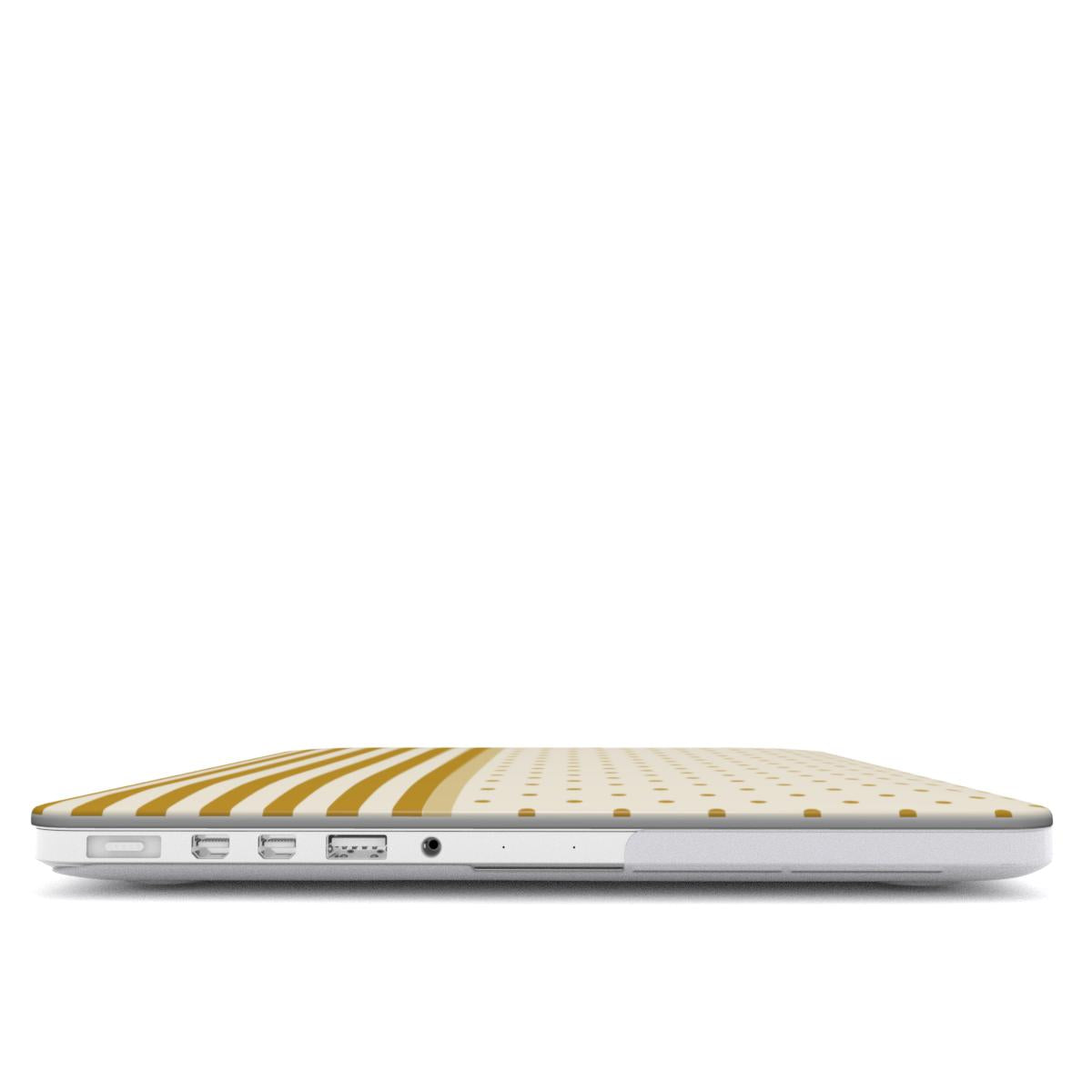 Butter Yellow - MacBook Case